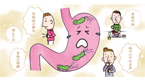 ピロリ菌　症状